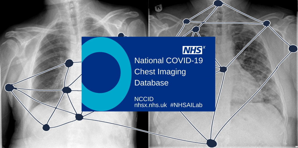 National COVID-19 Chest Imaging Database